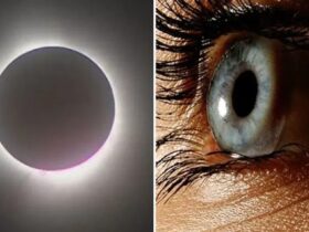 Post-Eclipse Concerns About Eye Damage Increase in the US. Credit | Getty Images