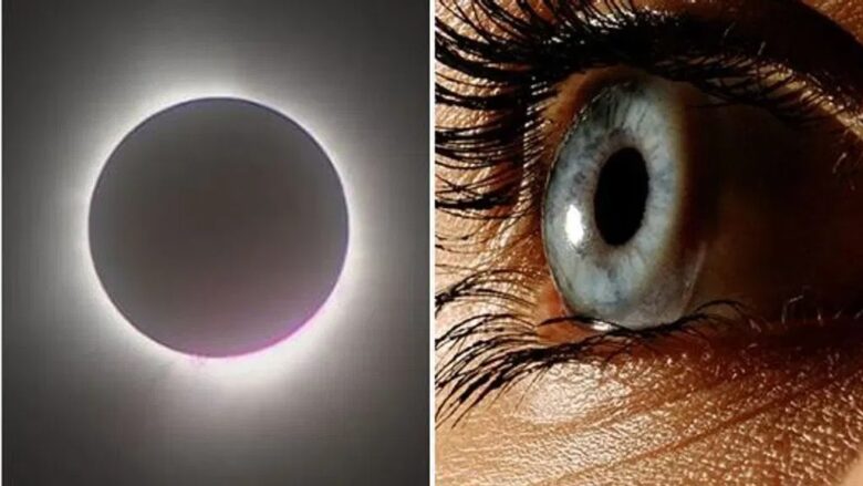 Post-Eclipse Concerns About Eye Damage Increase in the US. Credit | Getty Images